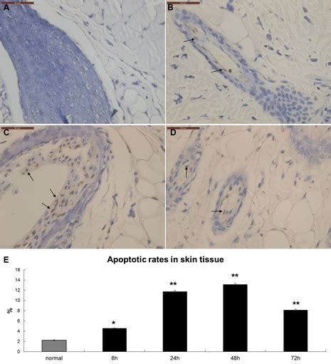 TUNEL Staining Of Normal Skin A And Burn Wound Tissue 24 B 48 C