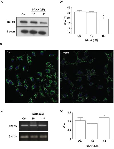 The Histone Deacetylase Inhibitor Saha Induces Hsp60 Nitration And Its