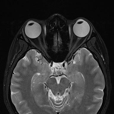 Image Radiopaedia Org