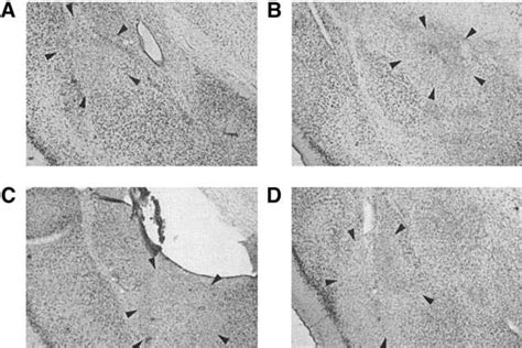 Neurotoxic amygdala lesions. The photomicrographs are of thionin ... 