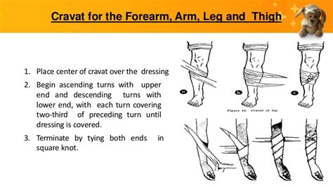 Bandaging Triangular Bandaging And Cravat Types Of Knots