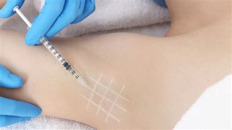 Hyperhidrose Behandlung Botox Stoppt Den Schwei