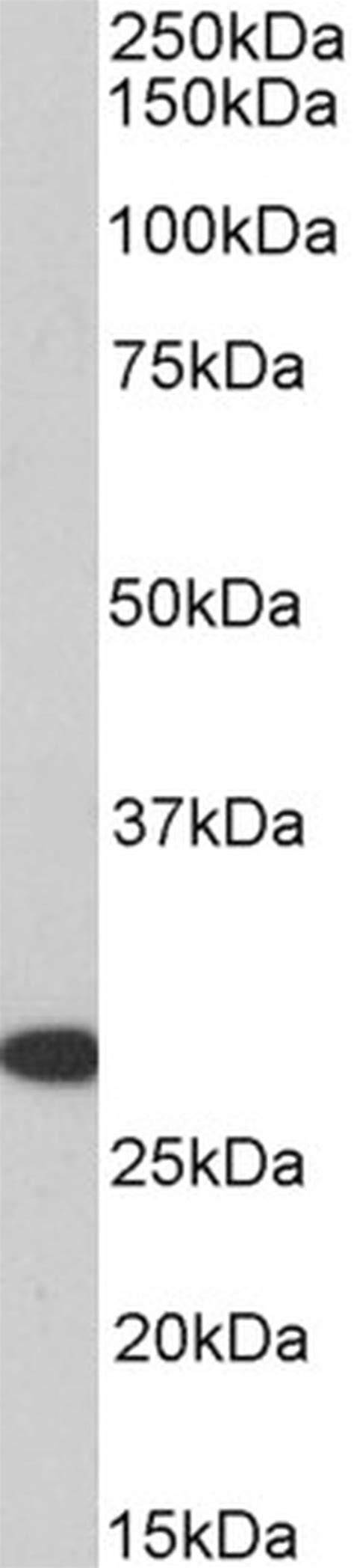 Hoxa5 Polyclonal Antibody Pa5 143085