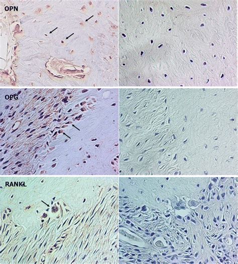 Representative Immunohistochemical Reactivity Arrows For OPN