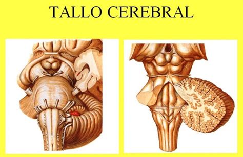 Tallo Cerebral ¿qué Es Funciones Partes Lesiones Síndromes Y Más