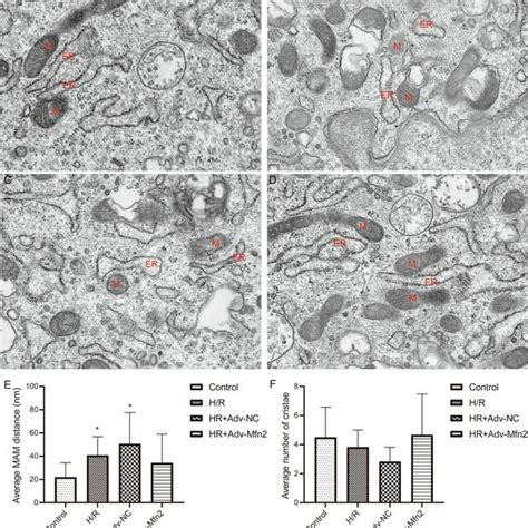 Transmission Electron Microscope Analysis Of Endoplasmic Reticulum And