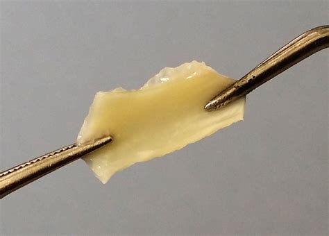 elastin simple english wikipedia   encyclopedia