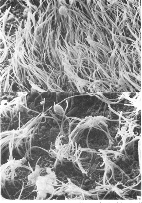 Figure 1 from Surface ultrastructure of human ependyma. | Semantic Scholar