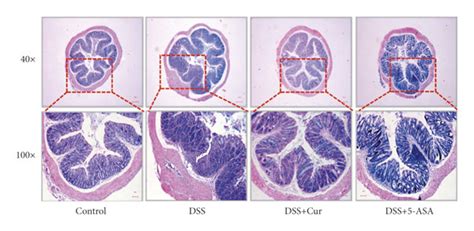 Curcumin Relieved Dss Induced Colitis In Mice A The Body Weight From