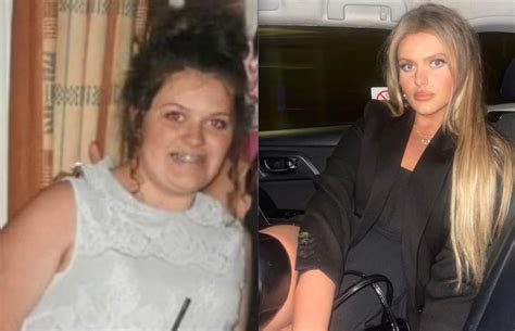 UK Woman Reveals Sad Revelation After 70 Pound 32 Kg Weight Loss