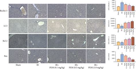 PEM Pretreatment Ameliorates Apoptosis And Autophagy In Hepatic IRI