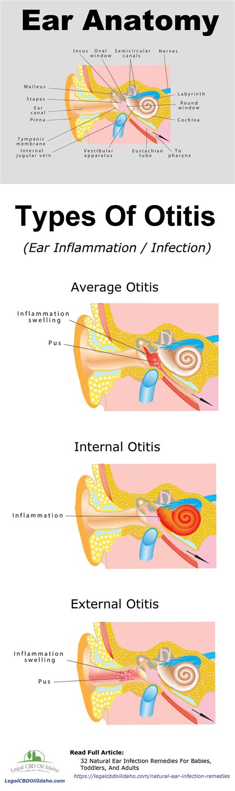 Ear Infections Types Causes Symptoms Treatment And Prevention Images