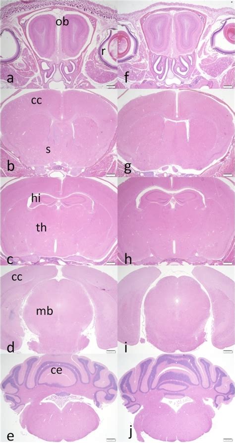 Pone G Tyr In The Intracellular Domain Of App Regulates