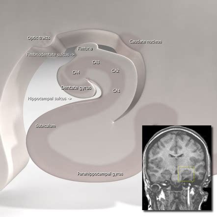 Hippocampus Anatomy Mri