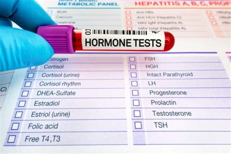 Why Lab Testing Is Crucial Before You Start Bioidentical Hormone