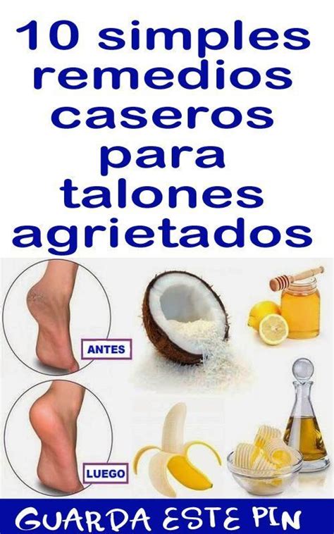 10 Simples Remedios Caseros Para Talones Agrietados Remedio Para Pies