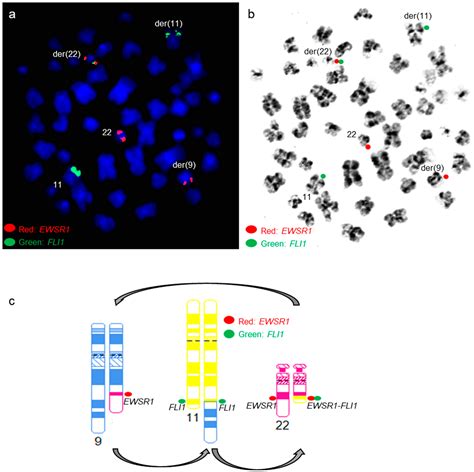 Genes Free Full Text Complexcryptic Ewsr1fli1erg Gene Fusions