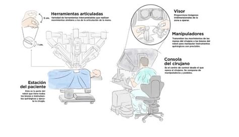 Cirugía robótica una realidad en México y América Latina DPL News