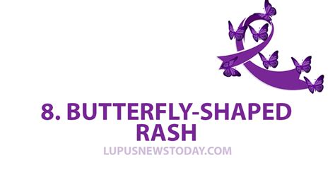 lupus symptoms