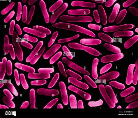 Farbige Scanning Electron Micrograph Sem Von Escherichia Coli Ist Ein