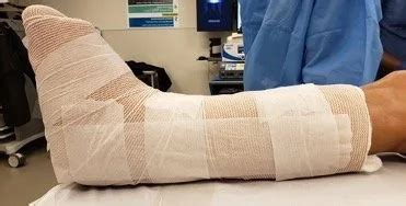 Ankle Fracture — Tonya An Md