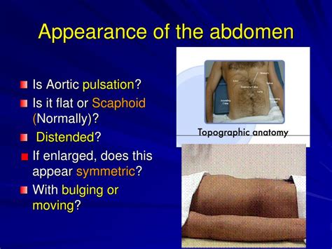 Ppt Abdominal Examination Powerpoint Presentation Free Download Id