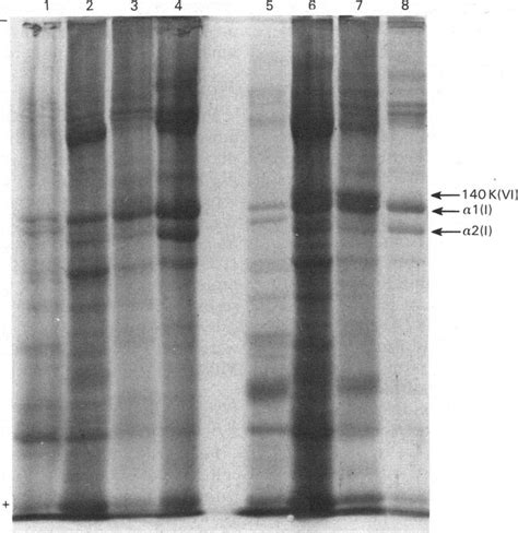 Sds Polyacrylamide Gel Electrophoresis Oj Dissociative Extracts From