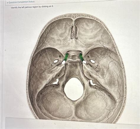 Solved Identify the left petrous region by clicking on it. | Chegg.com