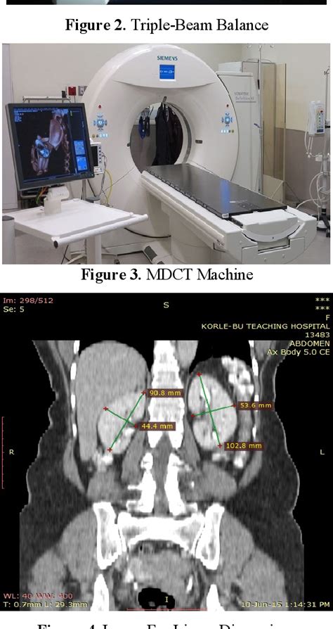 Figure 3 From Measurement Of Renal Dimensions To Determine Standard