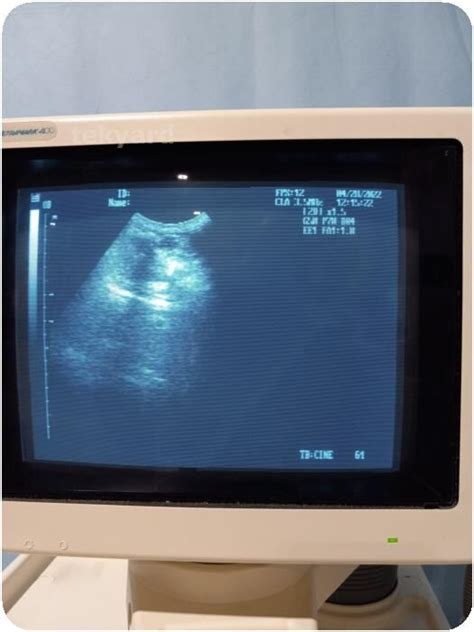 Used ATL Ultramark 400 Ultrasound System Ultrasound General For Sale - DOTmed Listing #4308433: