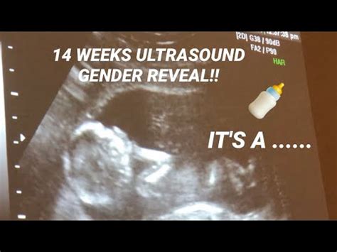 14 WEEKS ULTRASOUND GENDER REVEAL YouTube