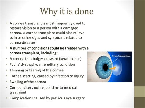 Ppt Cornea Transplant Procedure Powerpoint Presentation Free Download Id11477664