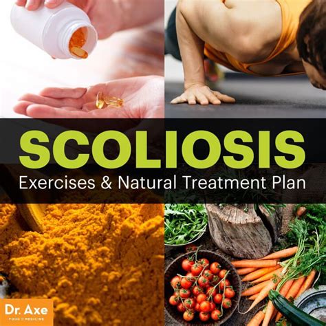 How To Treat Scoliosis Naturally Mapasgmaes