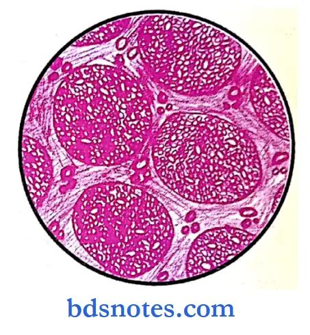 Different Types Of Oral Pathology Slides Notes - BDS Notes