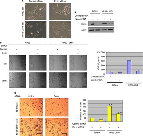 Ezrin Contributes To Lmp Induced Changes In Cell Phenotype A Lmp