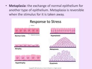 Metaplasia & Dysplasia | PPT