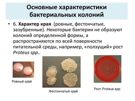 Бактериологический анализ - презентация онлайн