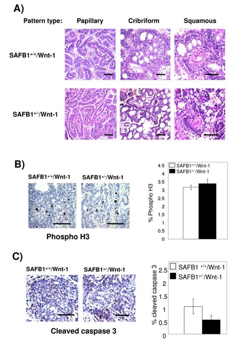 Histological Evaluation Of Wnt 1 Tumors Of Different Safb1 Genotype A