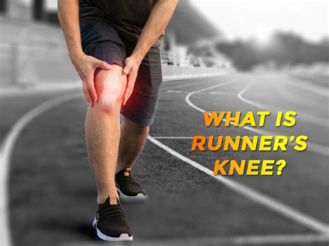 What Is Runner’s Knee? Signs, Symptoms and Treatment - Dr Firoz Ahmed