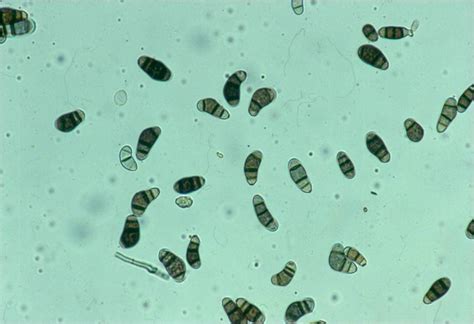 Curvularia conidia — Plant & Pest Advisory