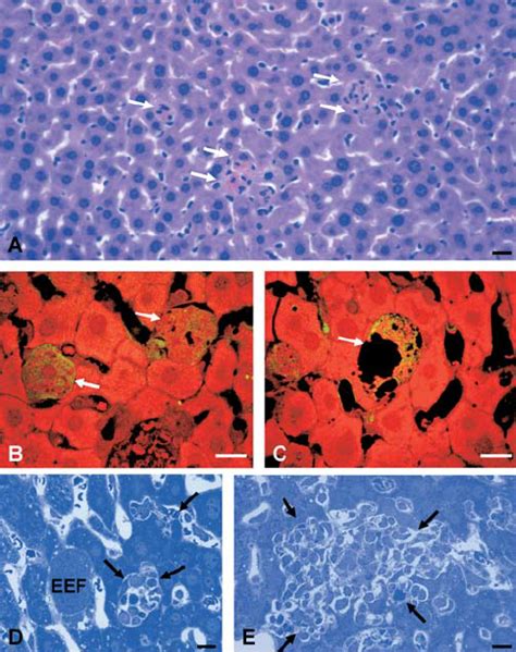 Transmigrating Plasmodium Sporozoites Leave Behind A Trail Of Dead