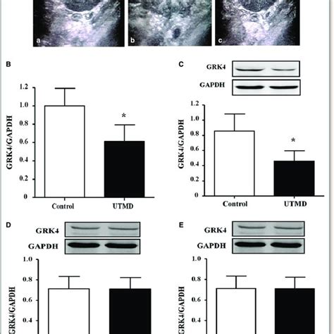 Inhibitory Effects Of Ultrasound Targeted Microbubble Destruction