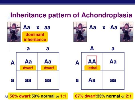 Achondroplasia At Emaze Presentation