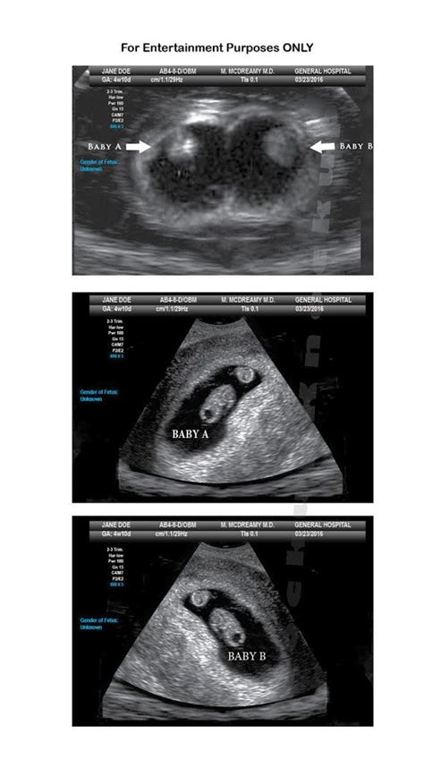 Ultrasonido Ecografia De Ni A Y Ni O Diferencias Ultrasonido Pelvis