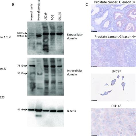 Expression Of Lhcgr In Normal Prostate Pca And Pca Cell Lines A