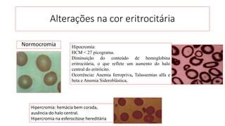 aula 1A Eritrograma e suas alterações pptx