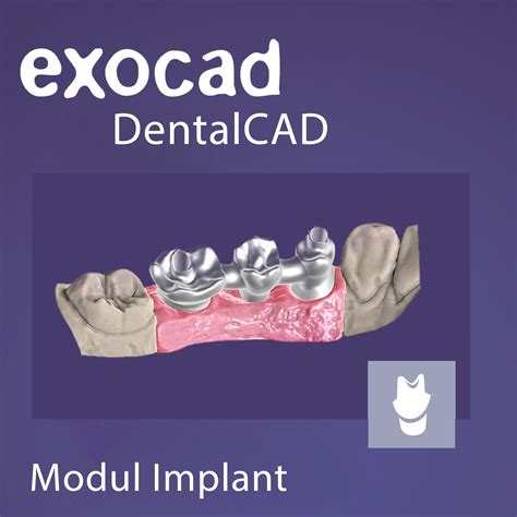 Exocad Dentalcad Modul Implant D Smart Dent Shop