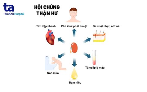 12 Biến Chứng Hội Chứng Thận Hư Cực Kỳ Nguy Hiểm Bạn Cần Biết Rõ