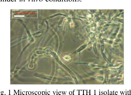 figure   trichoderma asperellum identified    fungal