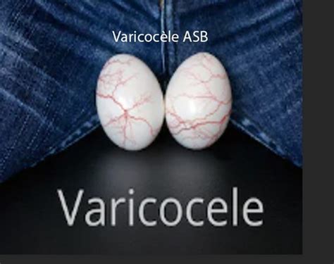 Varicocèle Complications Traitement Naturel Solution naturelle